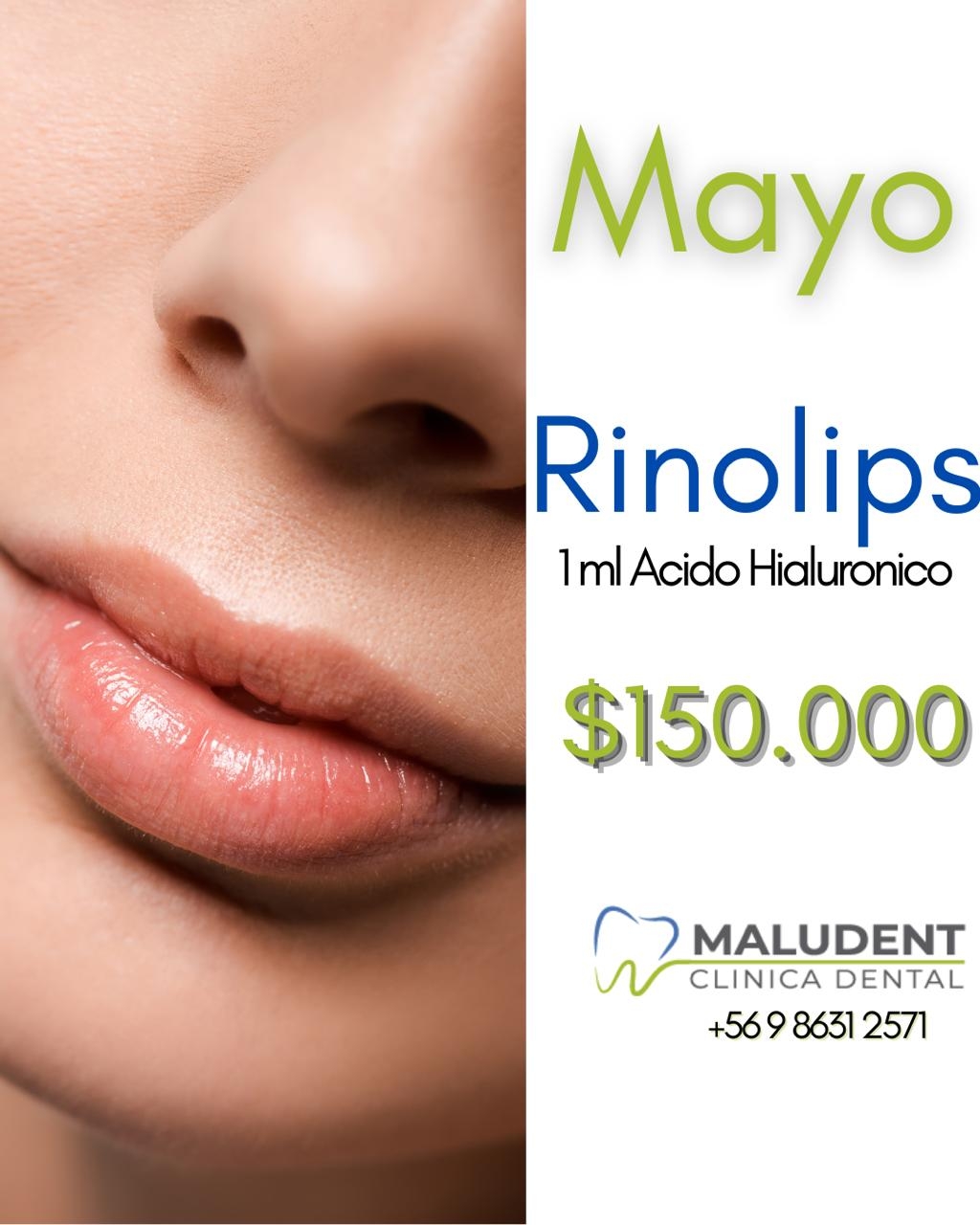 ¿Quieres darle un toque único y natural a tu rostro? 💁‍♀️ Este mayo, en MALUDEN...