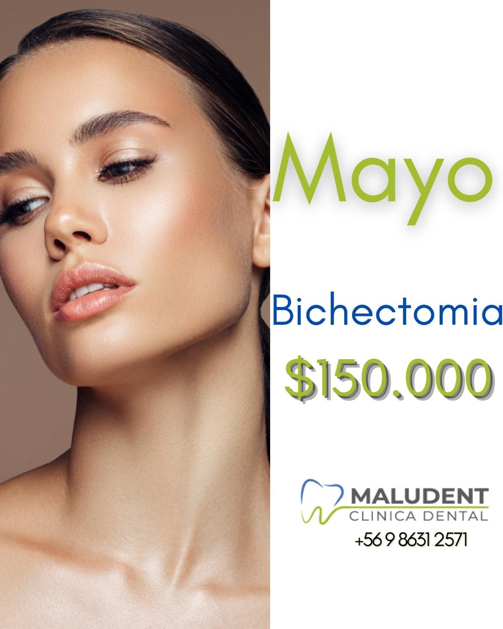 💫 Este mayo, afina tu rostro con nuestra promo de Bichectomía por solo $150.000 💸. ...