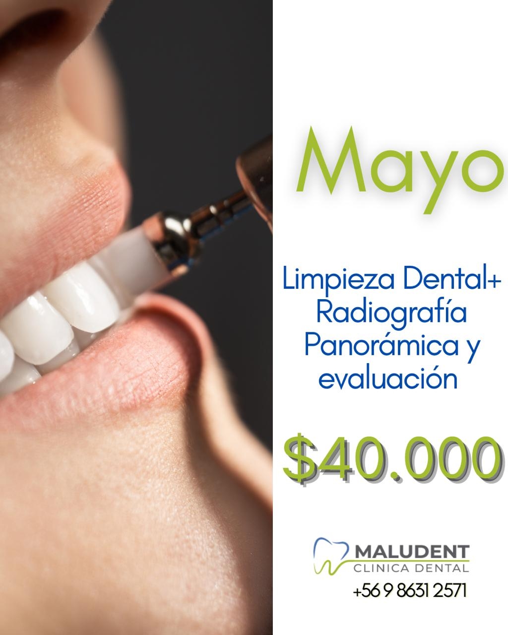 🦷 Este mayo, cuida tu sonrisa con nuestra promoción de Limpieza Dental + Radiografía ...