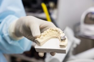 Especialistas en extracción de terceros molares y otras cirugías complejas de la cavidad oral. Atención segura, profesional y personalizada. ¡Confía en los expertos para tu salud bucal!